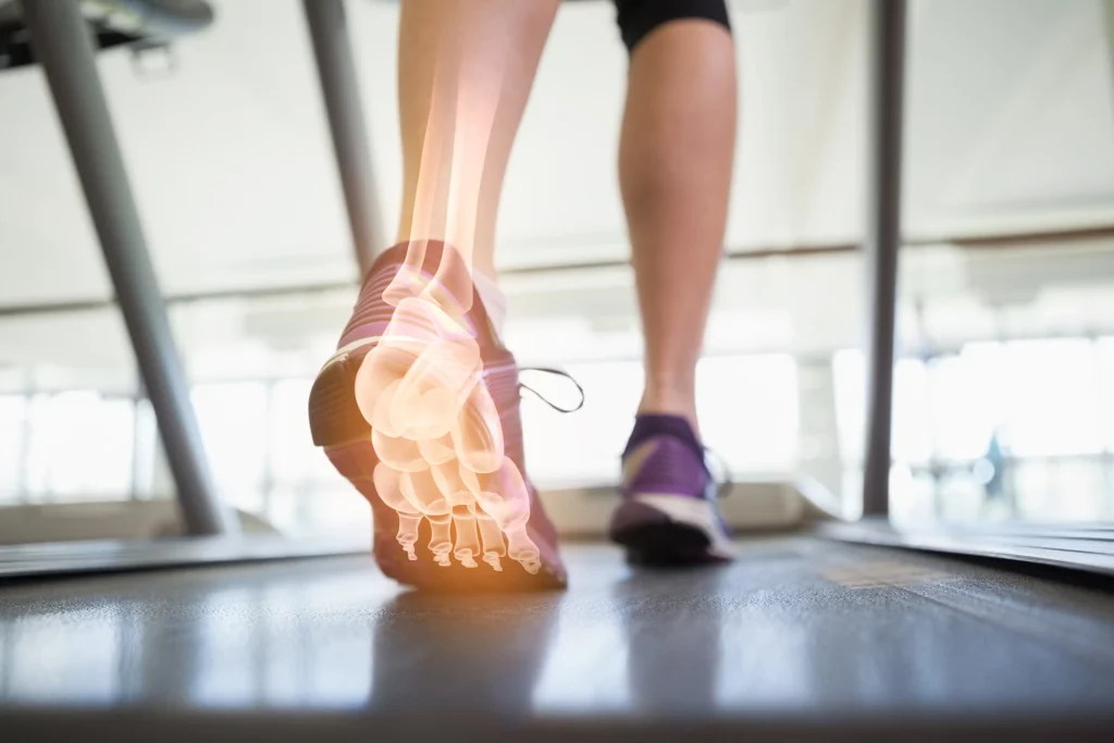 Is Custom Orthotics The Answer To Your Plantar Fasciitis.